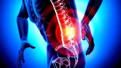 Fıtık Nedir? Nedenleri, Belirtileri ve Tedavisi Fıtık Nedir? Nedenleri, Belirtileri ve Tedavisi